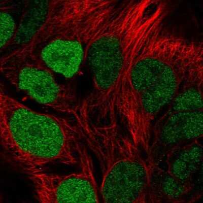 Immunocytochemistry/Immunofluorescence: SCL/Tal1 Antibody [NBP2-56907] - Staining of human cell line CACO-2 shows localization to nucleus. Antibody staining is shown in green. 