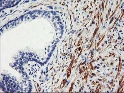 Immunohistochemistry: SCL/Tal1 Antibody (OTI5H1) - Azide and BSA Free [NBP2-74022] - Staining of paraffin-embedded Human prostate tissue using anti-Tal1 mouse monoclonal antibody.