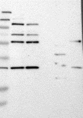Western Blot: SCL/Tal1 Antibody [25610002] - Samples:  Lane 1, Marker [kDa]: 250, 130, 95, 72, 55, 36, 28, 17, 11  Lane 2, RT-4 Lane 3, U-251MG sp Lane 4, Human Plasma Lane 5, Liver  Lane 6, Tonsil, Target weight [kDa]: 34    Validation score:  2   Validation description:  Supportive - Band of predicted size in kDa (+/-20%) with additional bands present.