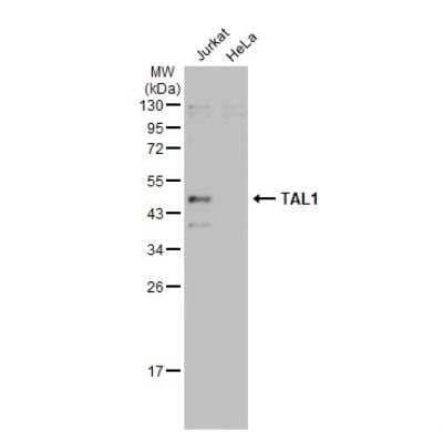 Western Blot SCL/Tal1 Antibody