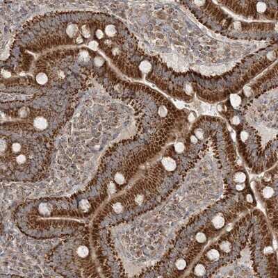 Immunohistochemistry-Paraffin: SCLT1 Antibody [NBP1-93891] - Staining of human duodenum shows strong cytoplasmic positivity, with a granular pattern in glandular cells.