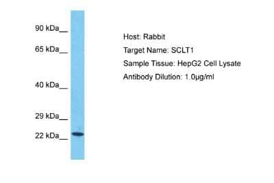 Western Blot: SCLT1 Antibody [NBP2-85696] - Host: Rabbit. Target Name: SCLT1. Sample Tissue: Human HepG2 Whole Cell. Antibody Dilution: 1ug/ml