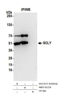 Immunoprecipitation: SCLY Antibody [NBP2-61229] - Detection of Human SCLY by Western Blot of Immunoprecipitates. Samples: Whole cell lysate (1.0 mg per IP reaction; 20% of IP loaded) from 293T cells prepared using NETN lysis buffer. Antibodies: Affinity purified rabbit anti-SCLY antibody NBP2-61229 used for IP at 20 ul per reaction. SCLY was also immunoprecipitated by rabbit anti-SCLY antibody. For blotting immunoprecipitated SCLY, NBP2-61229 was used at 1:250. Detection: Chemiluminescence with an exposure time of 30 seconds.