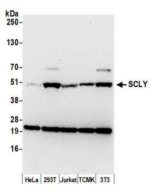 Western Blot: SCLY Antibody [NBP2-61229] - Detection of human and mouse SCLY by western blot. Samples: Whole cell lysate (15 ug) from HeLa, HEK293T, Jurkat, mouse TCMK-1, and mouse NIH 3T3 cells prepared using NETN lysis buffer. Antibody: Affinity purified rabbit anti-SCLY antibody NBP2-61229 used for WB at 1:1000. Detection: Chemiluminescence with an exposure time of 30 seconds.