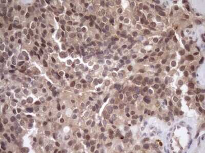 Immunohistochemistry SCMH1 Antibody (OTI5E6)
