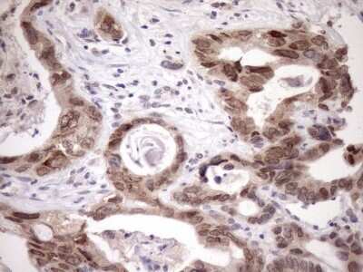 Immunohistochemistry SCMH1 Antibody (OTI5E6)