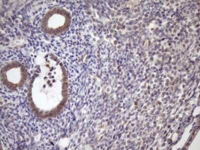 Immunohistochemistry SCMH1 Antibody (OTI5E6)