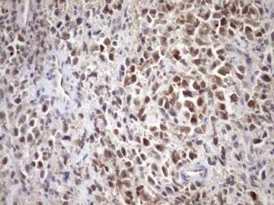 Immunohistochemistry: SCMH1 Antibody (5E6) [NBP2-45724] - Analysis of Human bladder tissue. (Heat-induced epitope retrieval by Tris-EDTA, pH8.0)