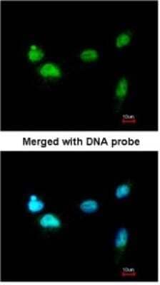 Immunocytochemistry/ Immunofluorescence SCMH1 Antibody - BSA Free