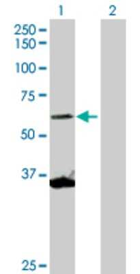 Western Blot: SCMH1 Antibody [H00022955-D01P] - Analysis of SCMH1 expression in transfected 293T cell line by SCMH1 polyclonal antibody.Lane 1: SCMH1 transfected lysate(73.40 KDa).Lane 2: Non-transfected lysate.
