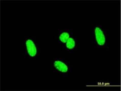 Immunocytochemistry/Immunofluorescence: SCML1 Antibody (4G3) [H00006322-M01] - Analysis of monoclonal antibody to SCML1 on HeLa cell . Antibody concentration 10 ug/ml.