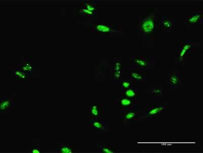 Immunocytochemistry/Immunofluorescence: SCML1 Antibody [H00006322-D01P] - Analysis of antibody to SCML1 on HeLa cell. Antibody concentration 30 ug/ml.
