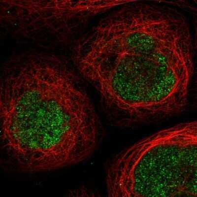 Immunocytochemistry/Immunofluorescence: SCML1 Antibody [NBP1-86309] - Immunofluorescent staining of human cell line A-431 shows localization to nucleus & nucleoli. Antibody staining is shown in green.