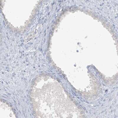 Immunohistochemistry-Paraffin: SCML1 Antibody [NBP1-85909] - Staining of human prostate shows low expression as expected.