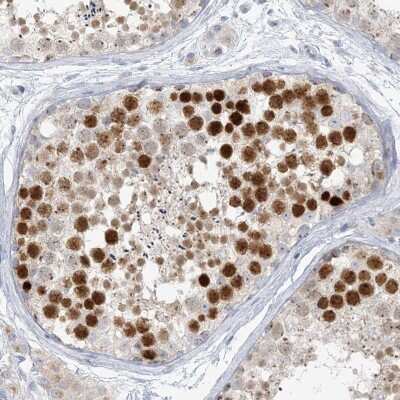 Immunohistochemistry-Paraffin: SCML1 Antibody [NBP1-85909] - Staining of human testis shows high expression.