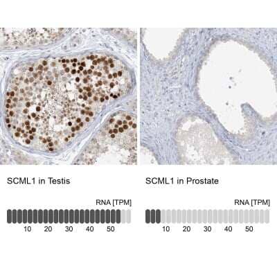 <b>Orthogonal Strategies Validation. </b>Immunohistochemistry-Paraffin: SCML1 Antibody [NBP1-85909] - Staining in human testis and prostate tissues using anti-SCML1 antibody. Corresponding SCML1 RNA-seq data are presented for the same tissues.