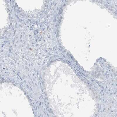 Immunohistochemistry-Paraffin: SCML1 Antibody [NBP1-86309] - Staining of human prostate shows low expression as expected.