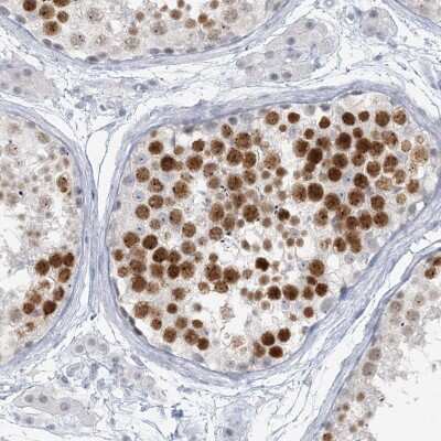 Immunohistochemistry-Paraffin: SCML1 Antibody [NBP1-86309] - Staining of human testis shows high expression.