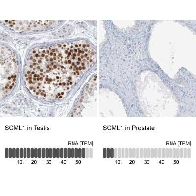 <b>Orthogonal Strategies Validation. </b>Immunohistochemistry-Paraffin: SCML1 Antibody [NBP1-86309] - Staining in human testis and prostate tissues using anti-SCML1 antibody. Corresponding SCML1 RNA-seq data are presented for the same tissues.