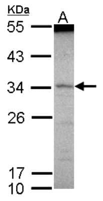 Western Blot: SCML1 Antibody [NBP2-20270] - Sample (30 ug of whole cell lysate) A: IMR32 12% SDS PAGE gel, diluted at 1:1000.