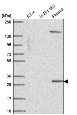 Western Blot: SCML1 Antibody [NBP2-55711] - Western blot analysis in human cell line RT-4, human cell line U-251 MG and human plasma.