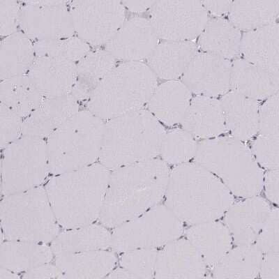 <b>Orthogonal Strategies Validation. </b>Immunohistochemistry-Paraffin: SCML2 Antibody [NBP2-56280] - Staining of human skeletal muscle shows low expression as expected.