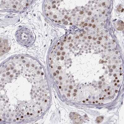 Immunohistochemistry-Paraffin: SCML2 Antibody [NBP2-56280] - Staining of human testis shows high expression.