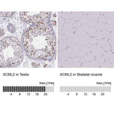 Immunohistochemistry-Paraffin: SCML2 Antibody [NBP2-56280] - Staining in human testis and skeletal muscle tissues using anti-SCML2 antibody. Corresponding SCML2 RNA-seq data are presented for the same tissues.