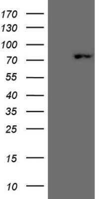 Western Blot: SCML2 Antibody (OTI1E1) - Azide and BSA Free [NBP2-74024] - Analysis of HEK293T cells were transfected with the pCMV6-ENTRY control (Left lane) or pCMV6-ENTRY SCML2.