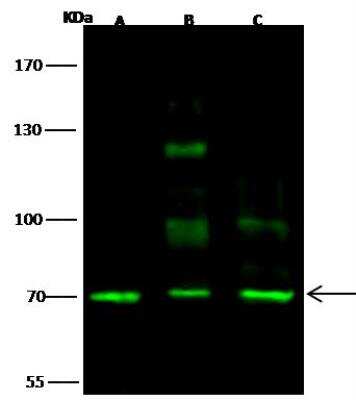 Western Blot: SCML2 Antibody [NBP2-99032] - Lane A: Hela Whole Cell LysateLane B: 293T Whole Cell LysateLane C: Jurkat Whole Cell LysateLysates/proteins at 30 ug per lane.SecondaryGoat Anti- Rabbit  IgG H&L (Dylight 800)  at 1/10000 dilution.Developed using the Odyssey technique. Performed under reducing conditions.Predicted band size:77 kDaObserved band size:70 kDa(We are unsure as to the identity of these extra bands.)