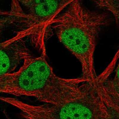 Immunocytochemistry/ Immunofluorescence SCML4 Antibody - BSA Free