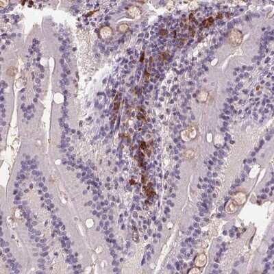 Immunohistochemistry-Paraffin SCML4 Antibody - BSA Free