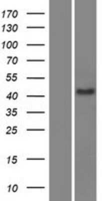Western Blot SCML4 Overexpression Lysate