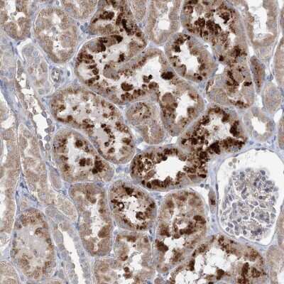 Immunohistochemistry: SCN11A Antibody [NBP2-48665] - Staining of human kidney shows strong cytoplasmic positivity in cells in tubules.