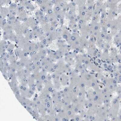 Immunohistochemistry-Paraffin: SCN4B Antibody [NBP1-86057] - Staining of human liver shows no positivity in hepatocytes as expected.