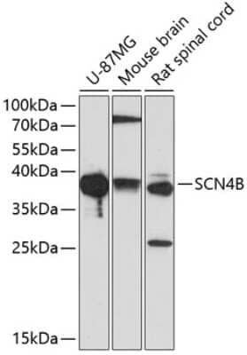 Western Blot: SCN4B Antibody [NBP2-93760] - Analysis of extracts of various cell lines, using SCN4B at 1:1000 dilution. Secondary antibody: HRP Goat Anti-Rabbit IgG (H+L) at 1:10000 dilution. Lysates/proteins: 25ug per lane. Blocking buffer: 3% nonfat dry milk in TBST. Detection: ECL Basic Kit . Exposure time: 90s.