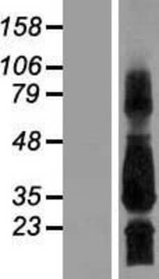 Western Blot: SCN4B Overexpression Lysate (Adult Normal) [NBP2-05056] Left-Empty vector transfected control cell lysate (HEK293 cell lysate); Right -Over-expression Lysate for SCN4B.