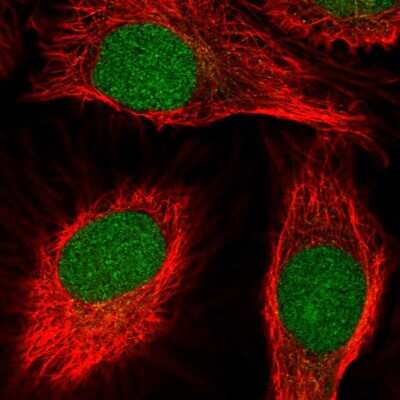 Immunocytochemistry/Immunofluorescence: SCNM1 Antibody [NBP2-55365] - Staining of human cell line HeLa shows localization to nucleus.