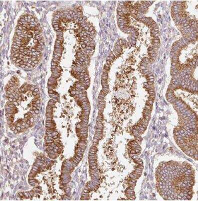 Immunohistochemistry: SCNM1 Antibody [NBP2-30728] - Staining of human uterus shows strong cytoplasmic positivity.