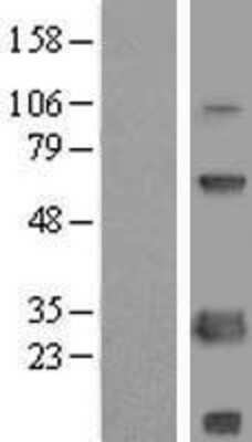 Western Blot: SCNM1 Overexpression Lysate (Adult Normal) [NBL1-15745] Left-Empty vector transfected control cell lysate (HEK293 cell lysate); Right -Over-expression Lysate for SCNM1.