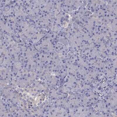 Immunohistochemistry-Paraffin SCNN1D Antibody