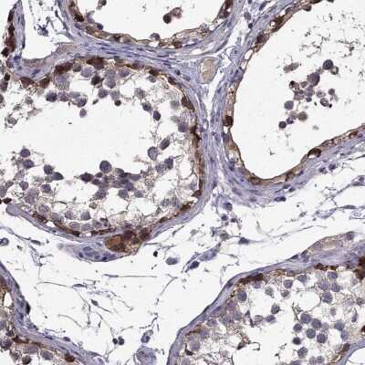 Immunohistochemistry-Paraffin SCNN1D Antibody