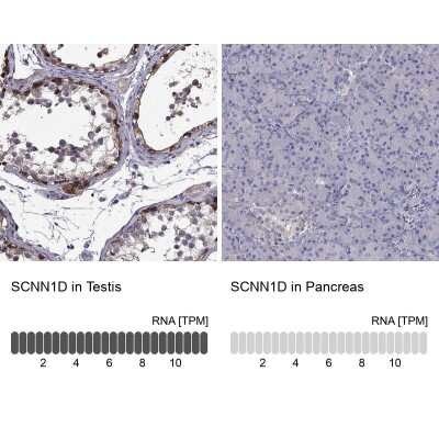 Immunohistochemistry-Paraffin: SCNN1D Antibody [NBP1-85004] - Staining in human testis and pancreas tissues using anti-SCNN1D antibody. Corresponding SCNN1D RNA-seq data are presented for the same tissues.