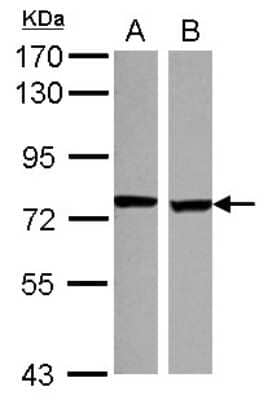 Western Blot SCNN1D Antibody