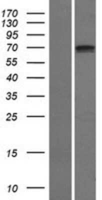 Western Blot SCNN1D Overexpression Lysate