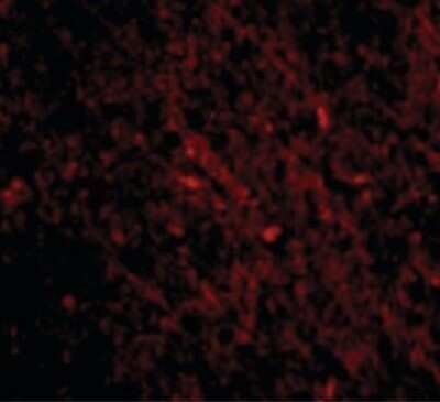 Immunofluorescence: SCO1 Antibody [NBP1-03207] - Immunofluorescence of SCO1 in Human Brain cells with SCO1 antibody at 20 ug/ml.