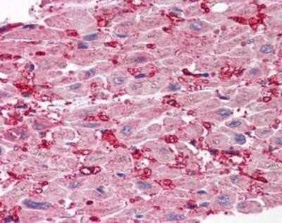 Immunohistochemistry-Paraffin: SCO1 Antibody [NBP1-03207] - Staining of human heart. Immunohistochemistry of formalin-fixed, paraffin-embedded tissue after heat-induced antigen retrieval. Antibody concentration 5 ug/ml.