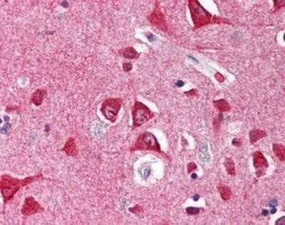 Immunohistochemistry-Paraffin: SCO1 Antibody [NBP1-03207] - Staining of human brain, cortex. Immunohistochemistry of formalin-fixed, paraffin-embedded tissue after heat-induced antigen retrieval. Antibody concentration 5 ug/ml.