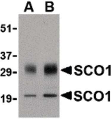 Western Blot: SCO1 Antibody [NBP1-03207] - Western blot of SCO1 in human brain tissue lysate with SCO1 antibody at (A) 0.5 and (B) 1 ug/ml.