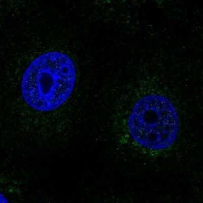 Immunocytochemistry/Immunofluorescence: SCO2 Antibody [NBP2-68675] - Staining of human cell line MCF7 shows localization to mitochondria.